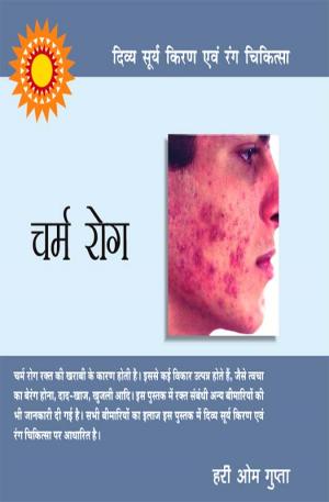 दिव्य सूर्य किरण एवं रंग चिकित्सा : चर्म रोग : Charm Rog