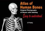 Atlas of Human Bones
