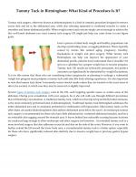 Tummy Tuck in Birmingham: What Kind of Procedure Is It?