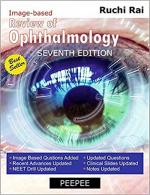 REVIEW OF OPHTHALMOLOGY