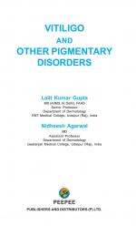 VITILIGO AND OTHER PIGMENTARY DISORDERS