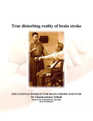 brain stroke awareness article english