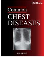 Common Chest Diseases