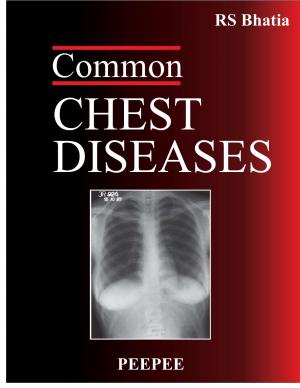 Common Chest Diseases